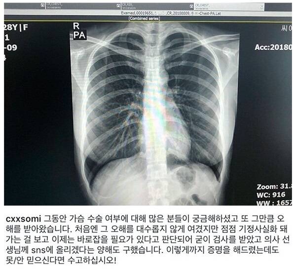 먹튀검증 참가슴_인증_그녀 스포츠토토티비닷컴